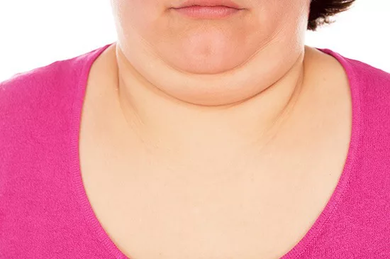 woman-lower-face-and-neck-showing-double-chin