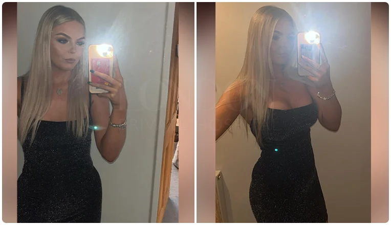 boob job before and after result patient-2