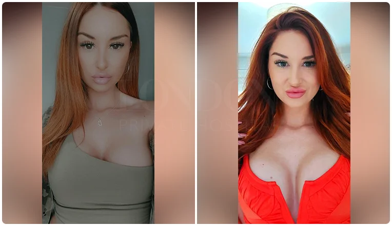 breast enlargement before and after result patient-10