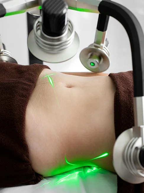 Woman undergoing a mummy makeover with lasers on her belly.