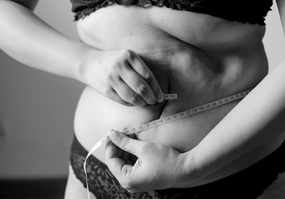 A woman measuring her abdomen with a tape, showing excess skin.