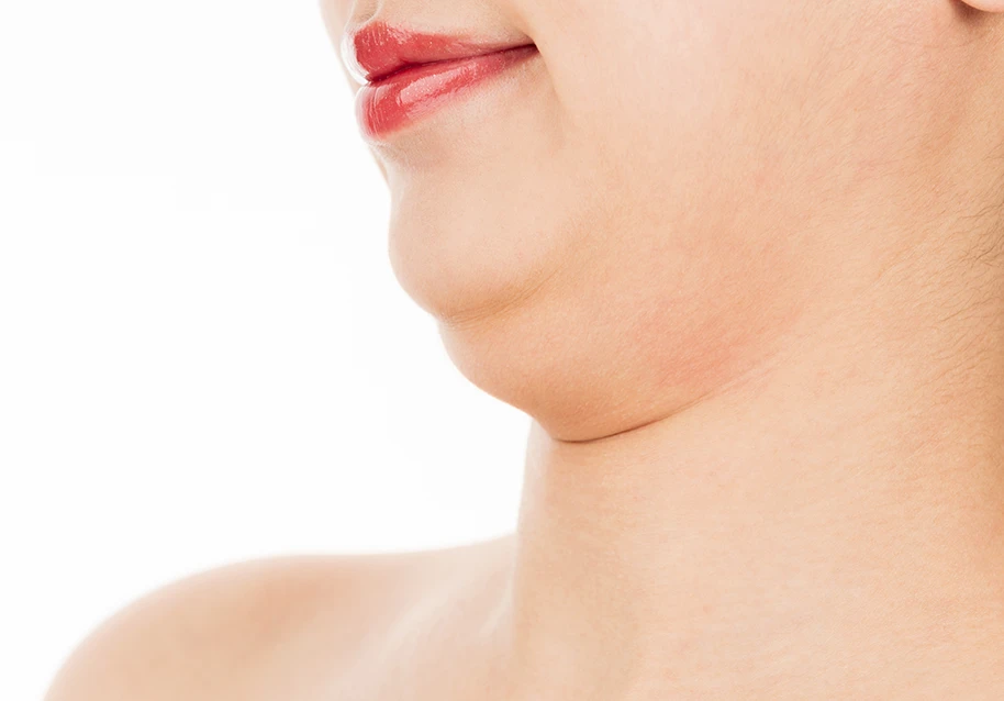 How to Get Rid of Double Chin: Best Treatment Options Explained