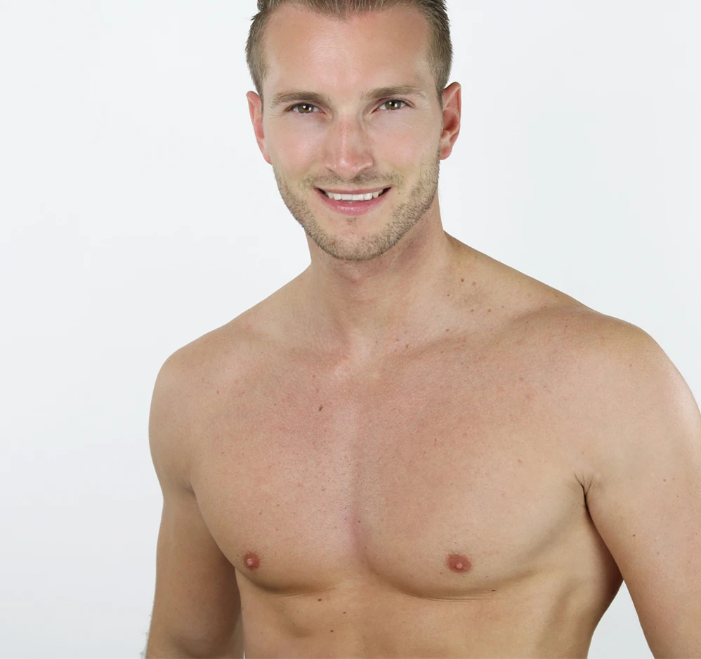 Smiling man with a flat, defined chest, representing gynecomastia surgery results