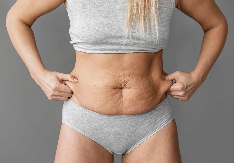 Tummy Tuck vs Mini Tummy Tuck: A London Patient Guide