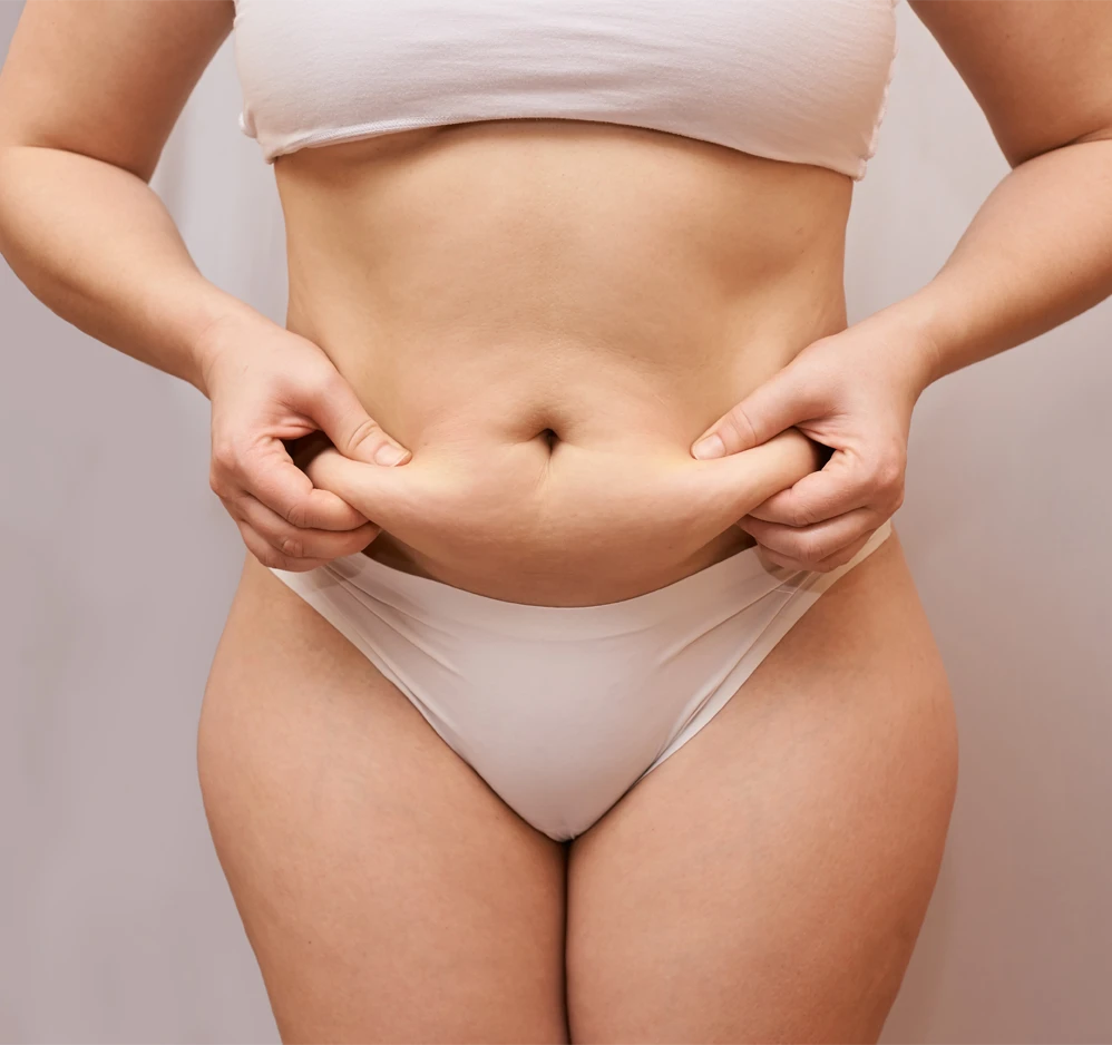Woman holding loose lower abdominal skin, representing mini tummy tuck treatment concerns